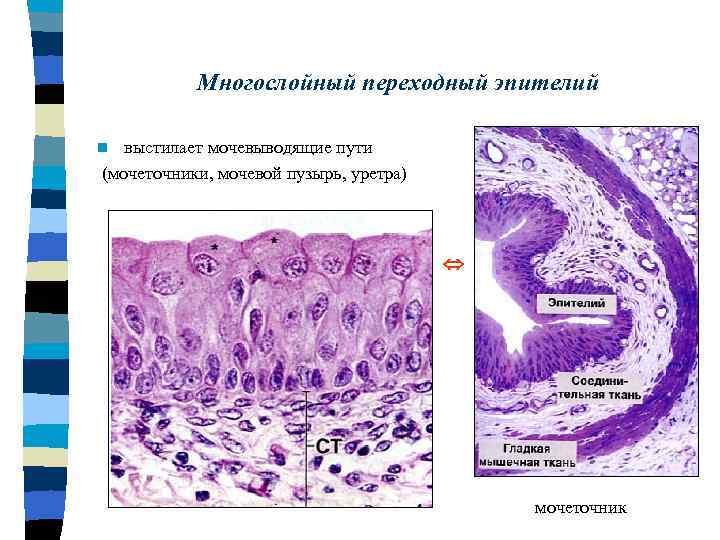 Переходный эпителий