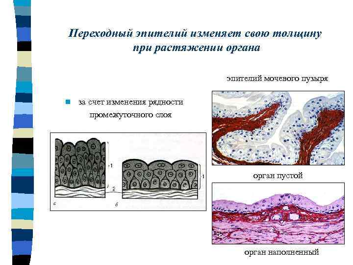 Изменение эпителия