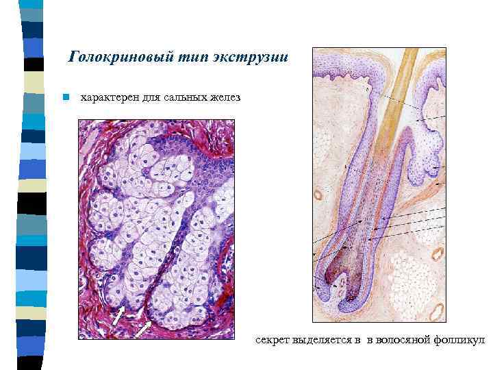 Голокриновый тип экструзии n характерен для сальных желез секрет выделяется в в волосяной фолликул