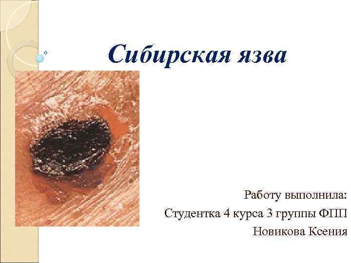 Сибирская язва Работу выполнила: Студентка 4 курса 3 группы ФПП Новикова Ксения 