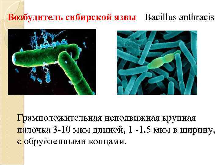 Возбудитель сибирской язвы - Bacillus anthracis Грамположительная неподвижная крупная палочка 3 -10 мкм длиной,