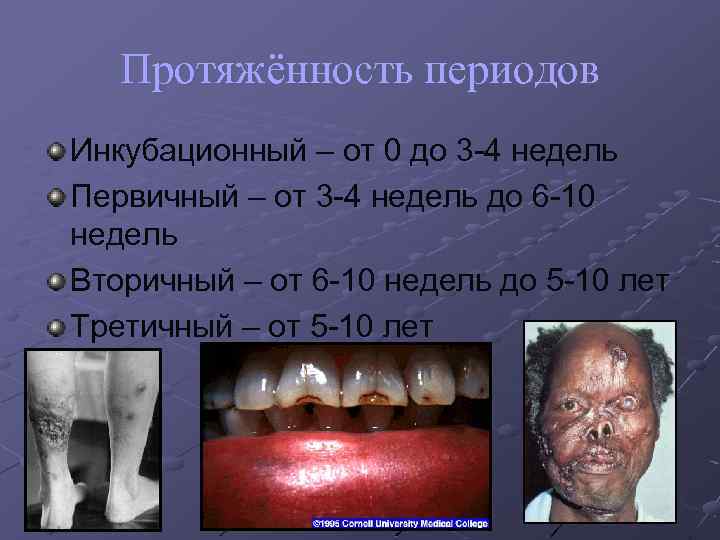 Протяжённость периодов Инкубационный – от 0 до 3 -4 недель Первичный – от 3