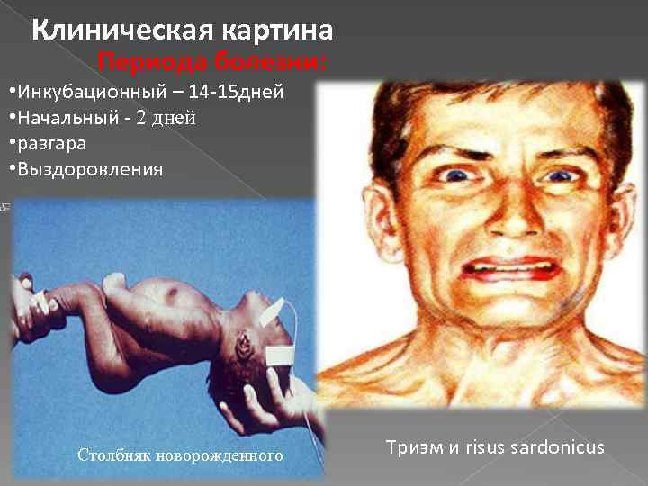Клиническая картина Периода болезни: • Инкубационный – 14 -15 дней • Начальный - 2