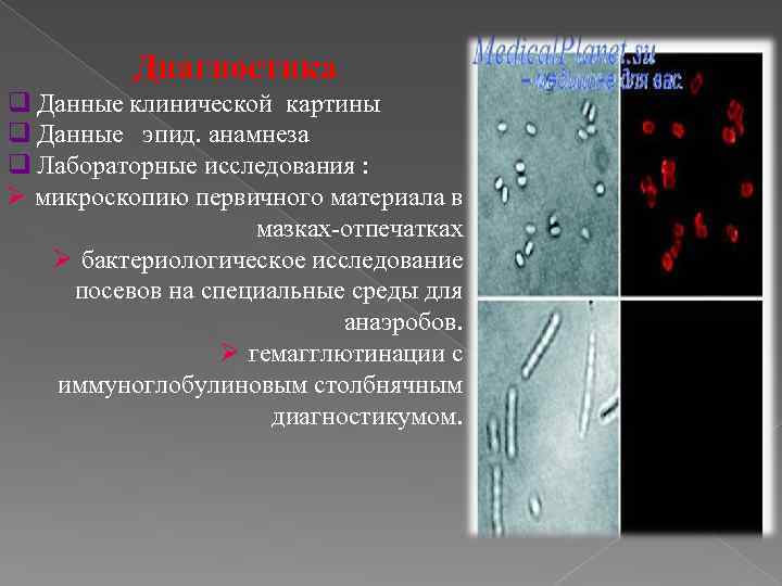 Диагностика q Данные клинической картины q Данные эпид. анамнеза q Лабораторные исследования : Ø