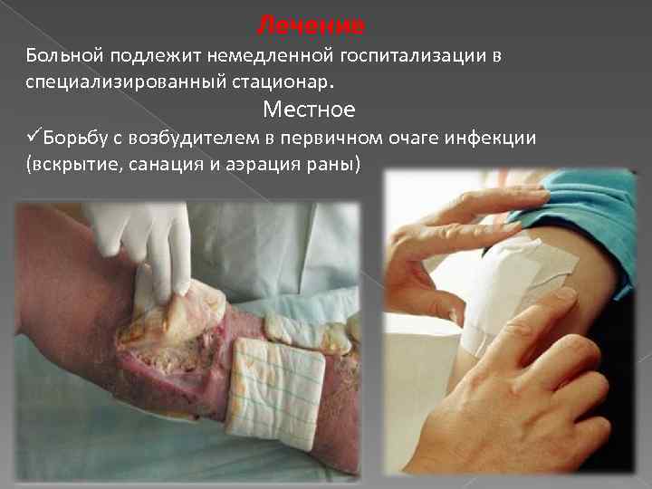 Лечение Больной подлежит немедленной госпитализации в специализированный стационар. Местное üБорьбу с возбудителем в первичном