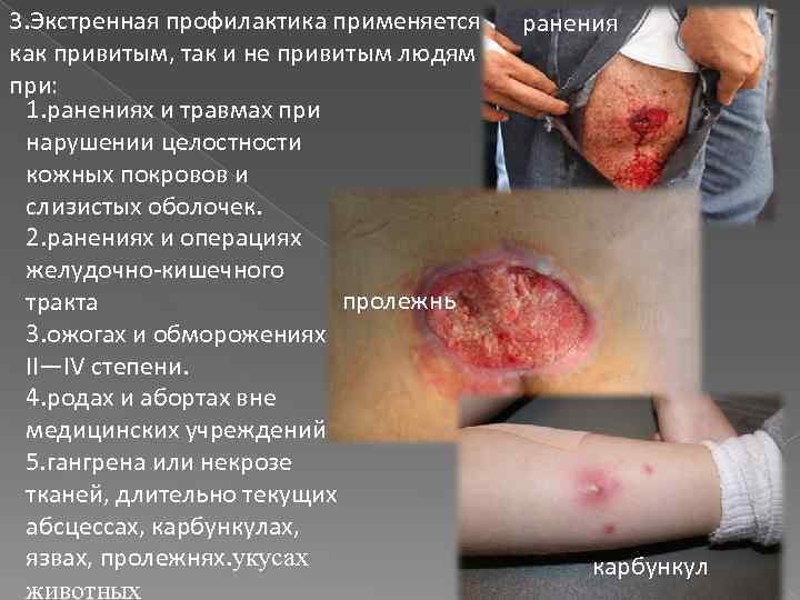 3. Экстренная профилактика применяется как привитым, так и не привитым людям при: 1. ранениях
