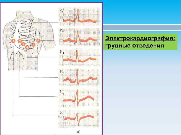Электрокардиография: грудные отведения 