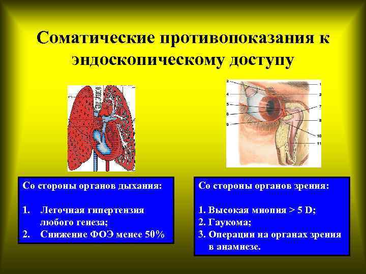 Соматические противопоказания к эндоскопическому доступу Со стороны органов дыхания: Со стороны органов зрения: 1.