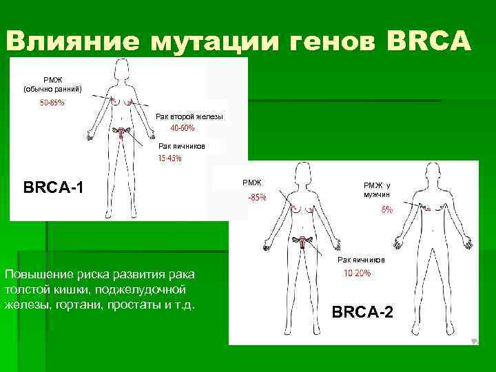 Brca2 рак молочной железы