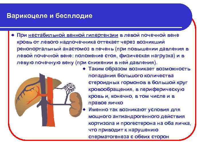 Варикоцеле и бесплодие При нестабильной венной гипертензии в левой почечной вене кровь от левого