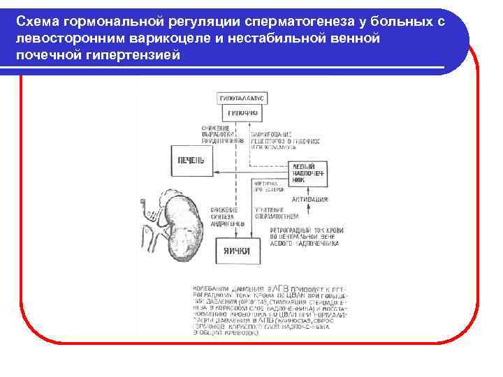 Схема гормональной регуляции сперматогенеза у больных с левосторонним варикоцеле и нестабильной венной почечной гипертензией