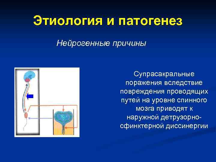 Этиология и патогенез Нейрогенные причины Супрасакральные поражения вследствие повреждения проводящих путей на уровне спинного