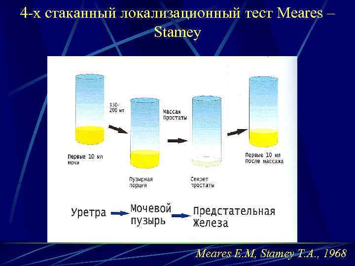4 -х стаканный локализационный тест Meares – Stamey Meares E. M, Stamey T. A.