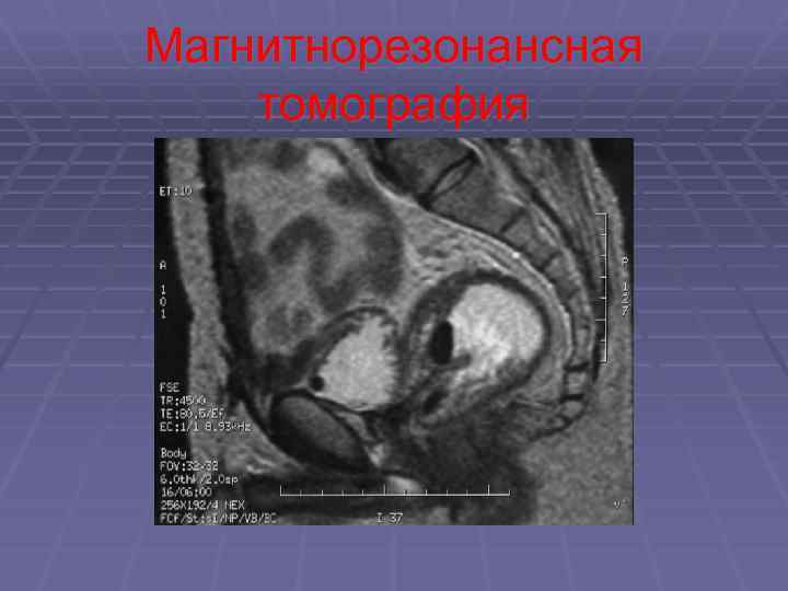 Магнитнорезонансная томография 