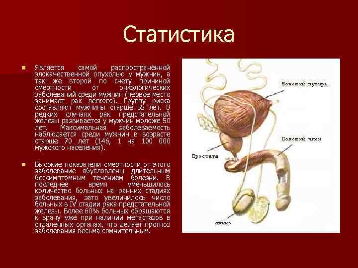 Статистика n Является самой распространённой злокачественной опухолью у мужчин, а так же второй по