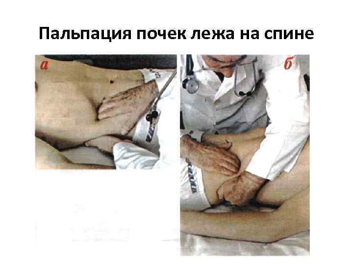 Пальпация почек лежа на спине 