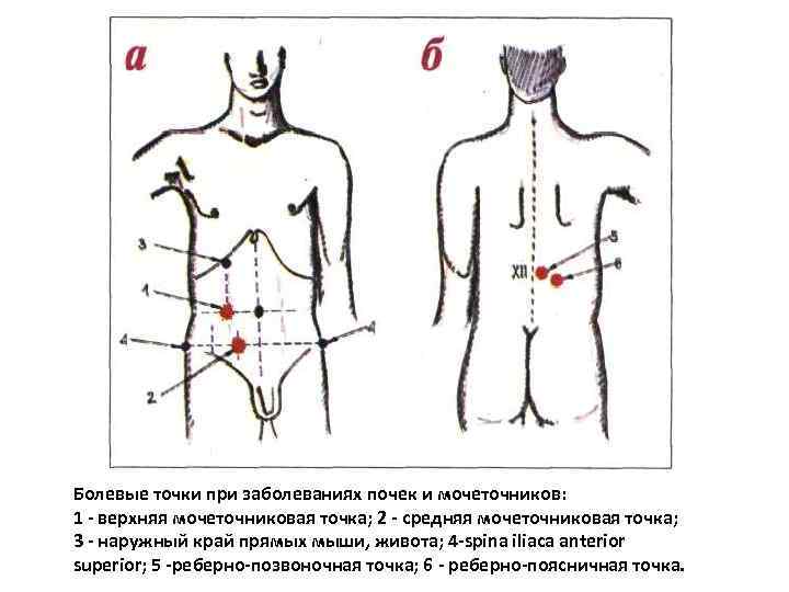 Болевые точки при заболеваниях почек и мочеточников: 1 - верхняя мочеточниковая точка; 2 -