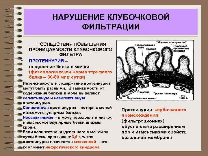НАРУШЕНИЕ КЛУБОЧКОВОЙ ФИЛЬТРАЦИИ • ПОСЛЕДСТВИЯ ПОВЫШЕНИЯ ПРОНИЦАЕМОСТИ КЛУБОЧКОВОГО ФИЛЬТРА ПРОТЕИНУРИЯ – выделение белка с