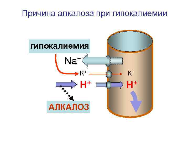 Причина алкалоза при гипокалиемия Na+ K+ K+ H+ H+ АЛКАЛОЗ 