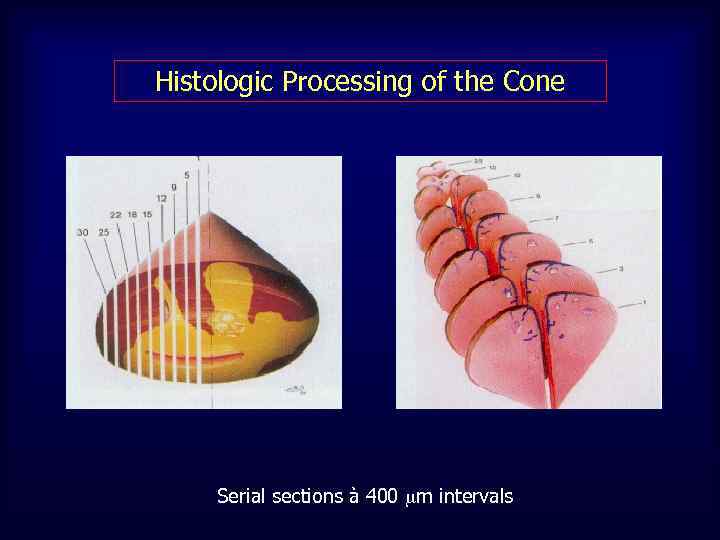 Histologic Processing of the Cone Serial sections à 400 m intervals 