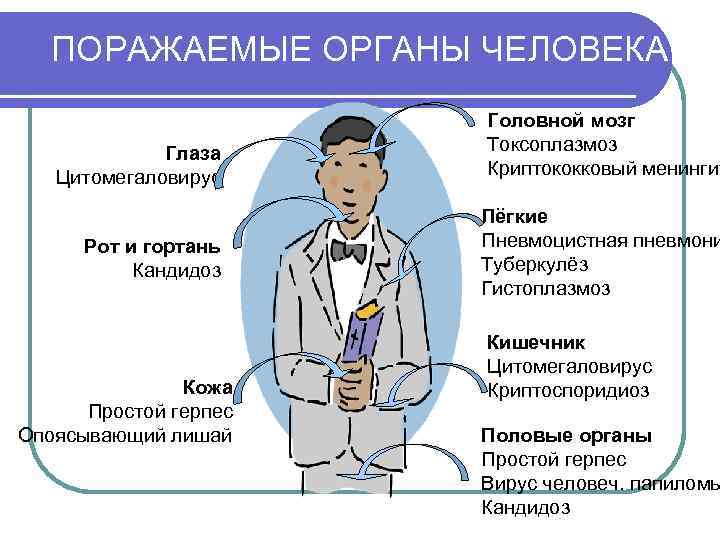 ПОРАЖАЕМЫЕ ОРГАНЫ ЧЕЛОВЕКА Глаза Цитомегаловирус Рот и гортань Кандидоз Кожа Простой герпес Опоясывающий лишай