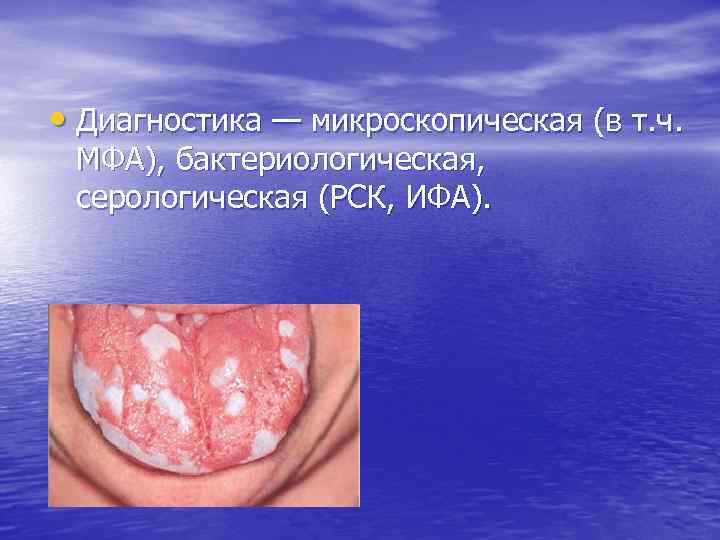  • Диагностика — микроскопическая (в т. ч. МФА), бактериологическая, серологическая (РСК, ИФА). 