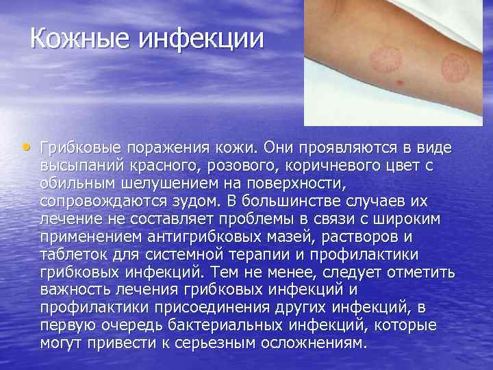 Кожные инфекции • Грибковые поражения кожи. Они проявляются в виде высыпаний красного, розового, коричневого
