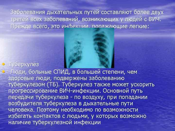 Заболевания дыхательных путей составляют более двух третей всех заболеваний, возникающих у людей с ВИЧ.