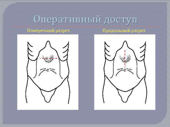 Оперативный доступ Поперечный разрез Продольный разрез 