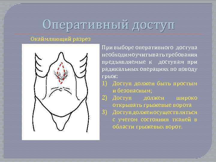 Оперативный доступ Окаймляющий разрез При выборе оперативного доступа необходимо учитывать требования предъявляемые к доступам