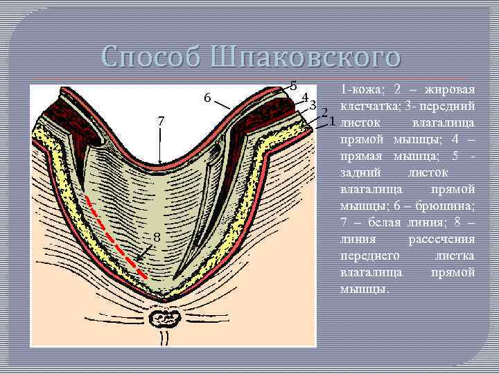 Способ Шпаковского 6 7 8 5 4 1 -кожа; 2 – жировая 3 2