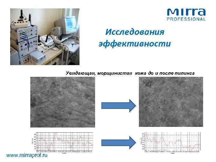 Исследования эффективности Увядающая, морщинистая кожа до и после пилинга www. mirraprof. ru 