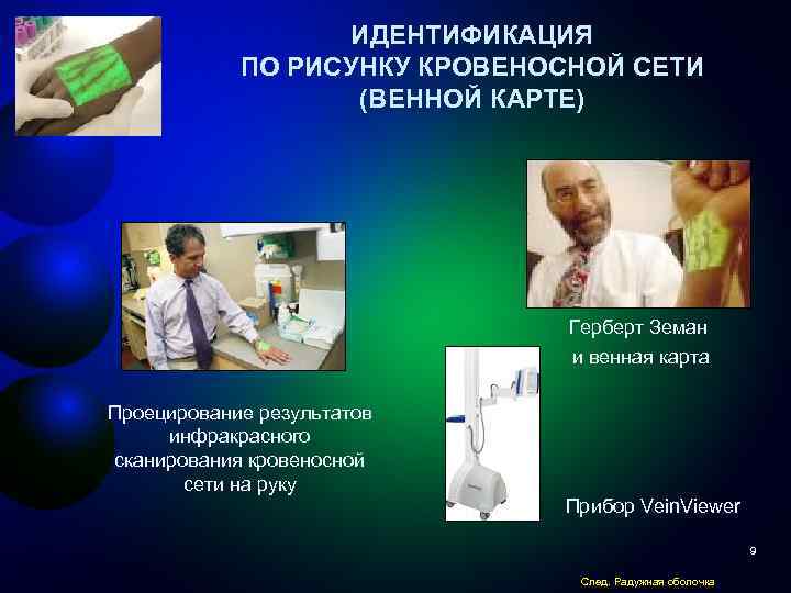 ИДЕНТИФИКАЦИЯ ПО РИСУНКУ КРОВЕНОСНОЙ СЕТИ (ВЕННОЙ КАРТЕ) Герберт Земан и венная карта Проецирование результатов