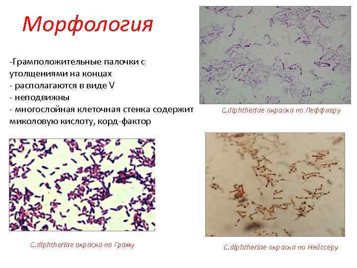 Морфология -Грамположительные палочки с утолщениями на концах - располагаются в виде V - неподвижны