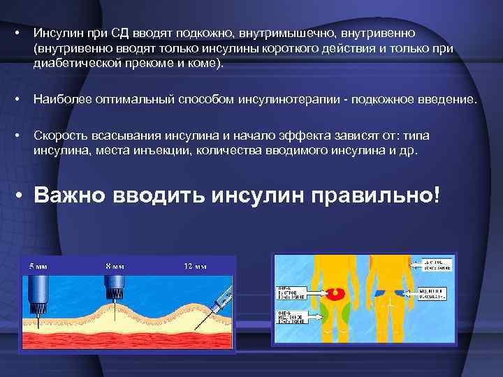  • Инсулин при СД вводят подкожно, внутримышечно, внутривенно (внутривенно вводят только инсулины короткого