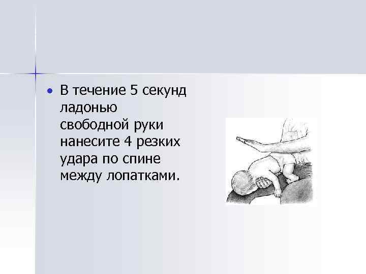  В течение 5 секунд ладонью свободной руки нанесите 4 резких удара по спине