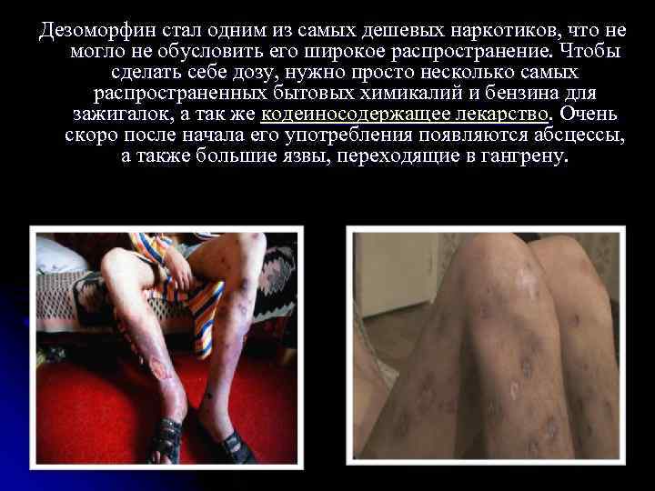 Дезоморфин стал одним из самых дешевых наркотиков, что не могло не обусловить его широкое