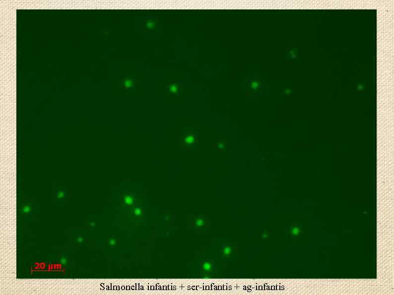 Salmonella infantis + ser-infantis + ag-infantis 