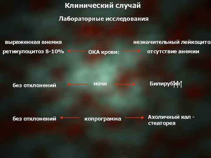 Клинический случай Лабораторные исследования выраженная анемия ретикулоцитоз 8 -10% без отклонений незначительный лейкоцитоз ОКА