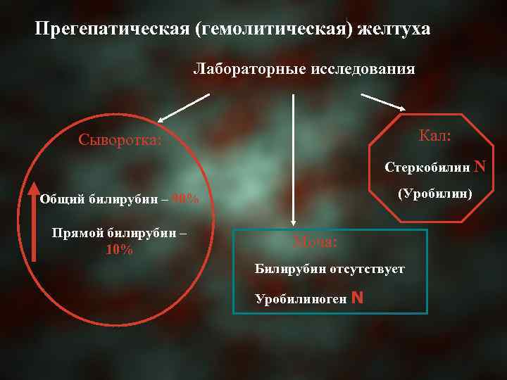 Прегепатическая (гемолитическая) желтуха Лабораторные исследования Кал: Сыворотка: Стеркобилин N (Уробилин) Общий билирубин – 90%