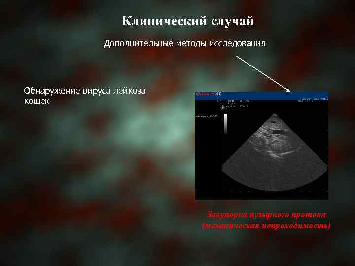 Клинический случай Дополнительные методы исследования Обнаружение вируса лейкоза кошек Закупорка пузырного протока (механическая непроходимость)