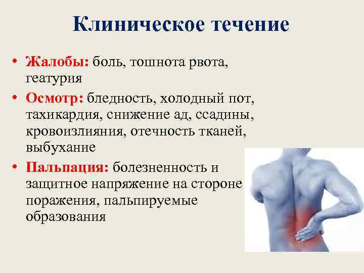 Клиническое течение • Жалобы: боль, тошнота рвота, геатурия • Осмотр: бледность, холодный пот, тахикардия,