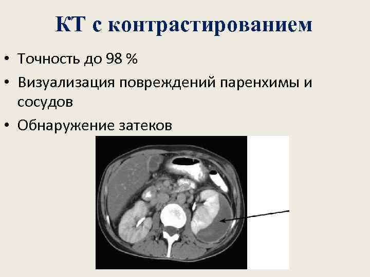 КТ с контрастированием • Точность до 98 % • Визуализация повреждений паренхимы и сосудов