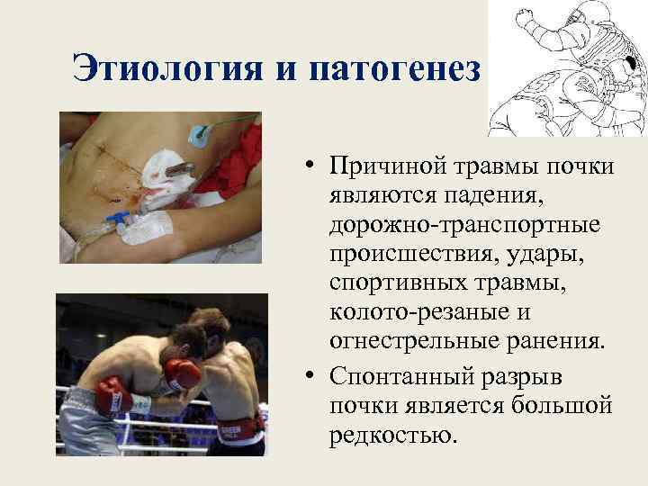 Этиология и патогенез • Причиной травмы почки являются падения, дорожно-транспортные происшествия, удары, спортивных травмы,