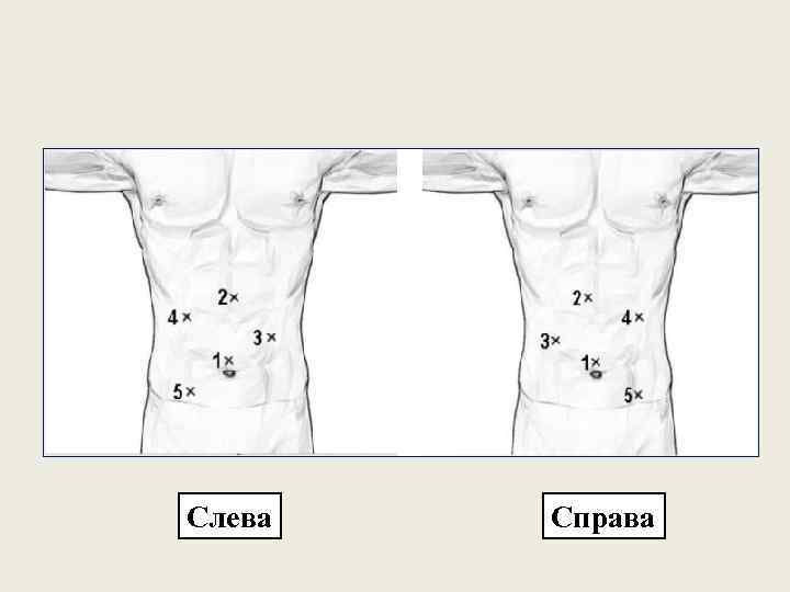 Слева Справа 