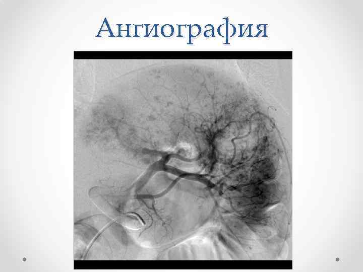 Ангиография 