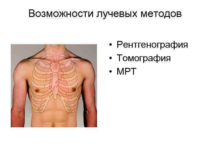 Возможности лучевых методов • Рентгенография • Томография • МРТ 