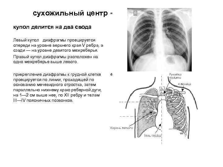 сухожильный центр купол делится на два свода Левый купол диафрагмы проецируется спереди на уровне