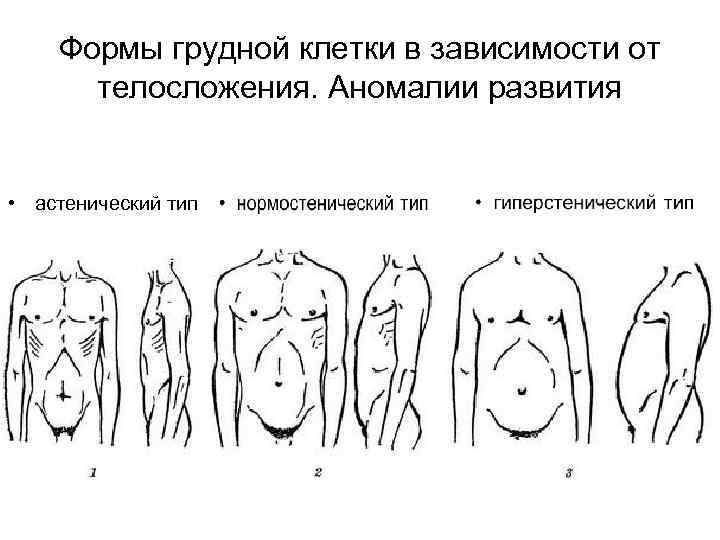 Формы грудной клетки в зависимости от телосложения. Аномалии развития • астенический тип 