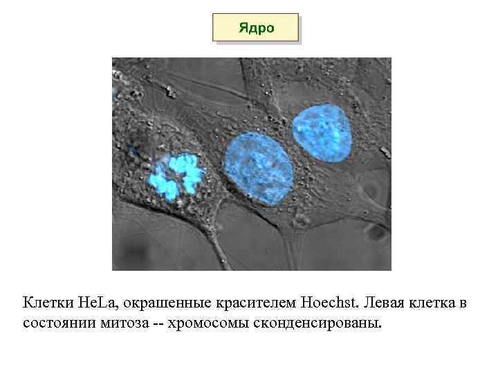 Клетки He. La, окрашенные красителем Hoechst. Левая клетка в состоянии митоза -- хромосомы сконденсированы.